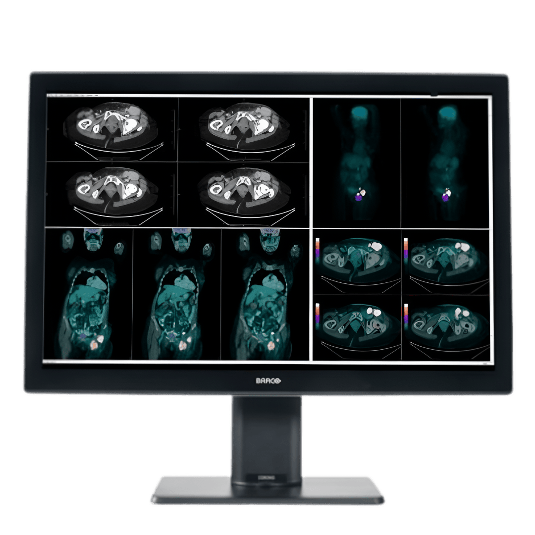 Coronis Fusion 4MP (MDCC-4430)